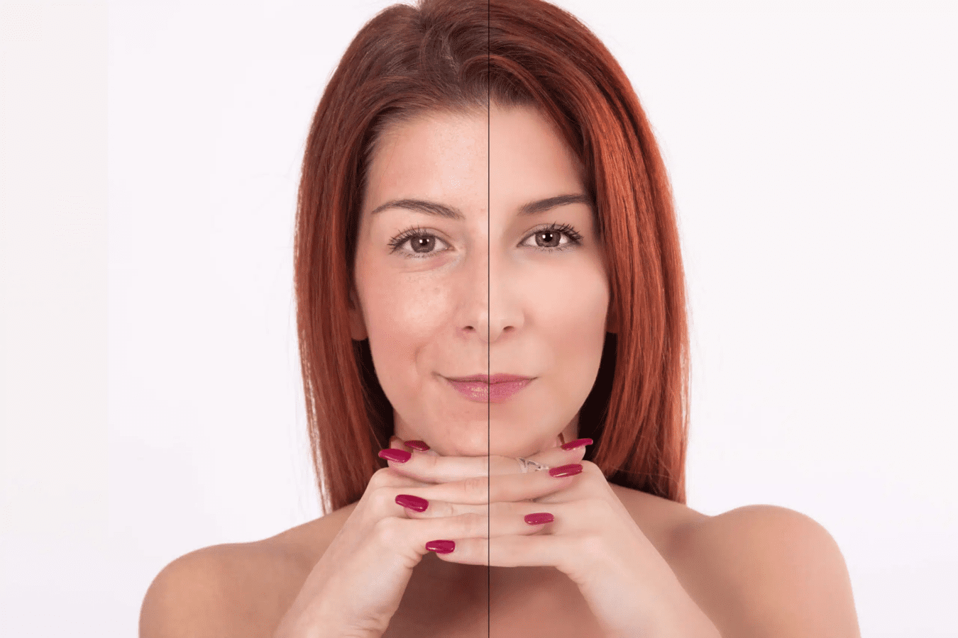 Comparison: Microneedling vs. Botox